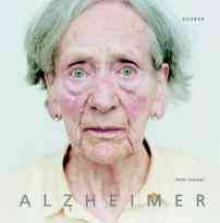 Προτεραιότητα η καταπολέμηση της νόσου Alzheimer, σύμφωνα με τους ευρωβουλευτές