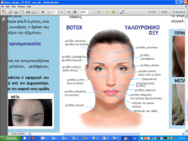 Botox & Υαλουρινικό Οξύ: Μύθοι και αλήθειες γύρω από τη χρήση τους και τα αποτελέσματά τους