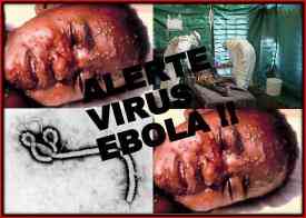 Τι είναι η ιογενής νόσος Ebola