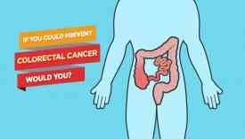 Καρκίνος εντέρου: 5 σημεία κλειδιά στη διατροφή