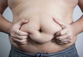 Η παχυσαρκία μπορεί να μειώσει τη ζωή του ανθρώπου κατά 8 χρόνια