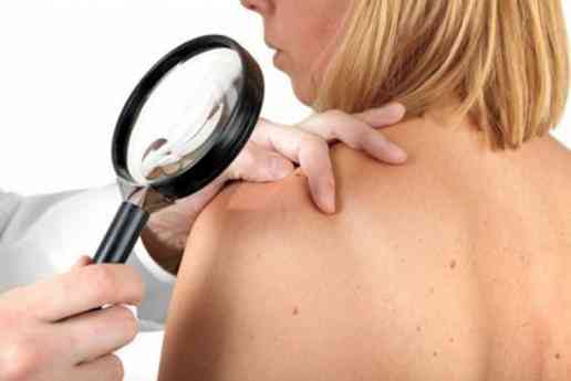 Το Ipilimumab για Ενήλικες Ασθενείς με Προχωρημένο Μελάνωμα μπαίνει στη θετική λίστα Το Ipilimumab για Ενήλικες Ασθενείς με Προχωρημένο Μελάνωμα μπαίνει στη θετική λίστα