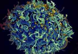 “Τ κύτταρα” η νέα ελπίδα από επαναστατική θεραπεία ενάντια σε ανίατους καρκίνους