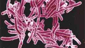Φυματίωση η δεύτερη πιο θανατηφόρα ασθένεια στον κόσμο μετά το AIDS