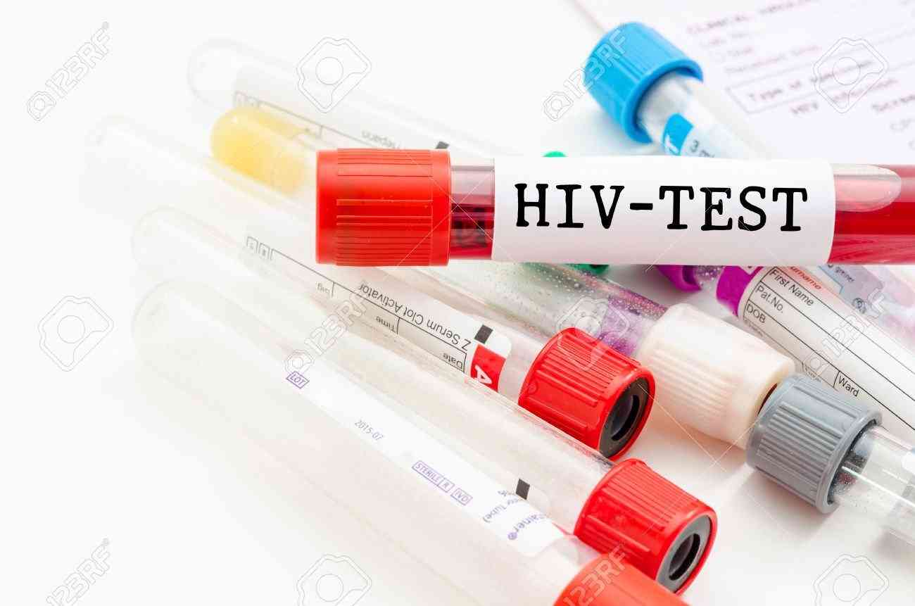 1η Δεκεμβρίου 2022, Παγκόσμια Ημέρα AIDS: “Δεν είμαστε όλοι εδώ, αλλά είμαστε ακόμη εδώ”