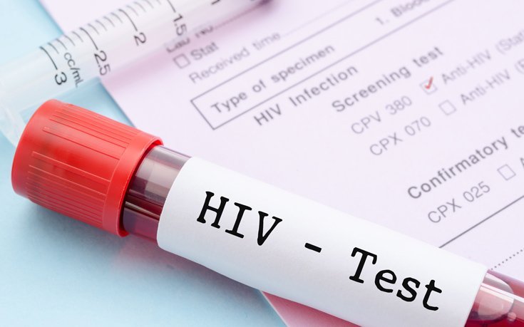 Αυξάνονται τα περιστατικά με HIV σε άτομα της μέσης και άνω ηλικίας