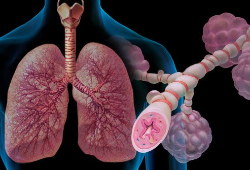 Η Sanofi και η Regeneron ανακοινώνουν θετικά αποτελέσματα για το Dupilumab από μία κλινική μελέτη Φάσης 3 για το μη ελεγχόμενο επίμονο άσθμα