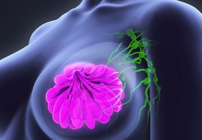 Καρκίνος του μαστού: Τι σχέση έχει με το βιολογικό ρολόι