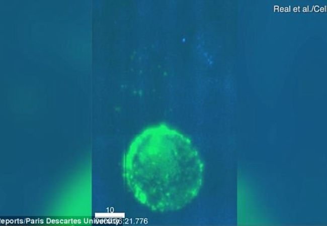 Σεξ: Δείτε πως ένα μολυσμένο με HIV κύτταρο μεταφέρει τον ιό κατά τη διάρκεια της πράξης (βίντεο)