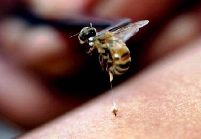 Τσίμπημα από μέλισσα ή σφήκα: Τι συμβαίνει στο σώμα μας
