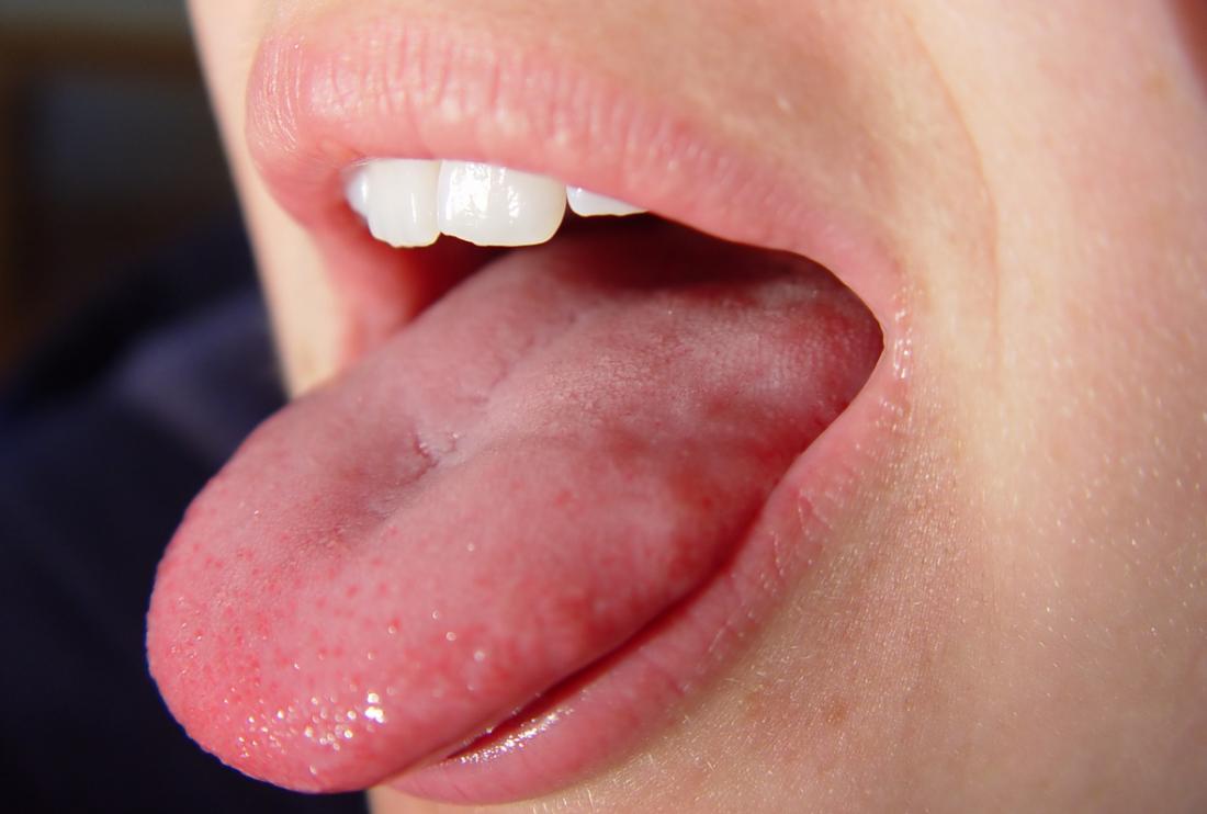 Οσφρηση: Μήπως μυρίζουμε και με τη γλώσσα μας;