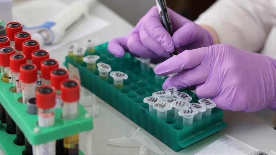 Αγωνία για τους Οροθετικούς- Χωρίς αντιδραστήρια τα Κέντρα Αναφοράς HIV