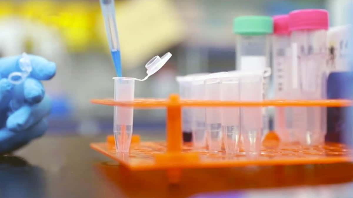 Κορωνοϊός: H CSL Behring και η SAB Biotherapeutics ενώνουν τις δυνάμεις τους για μια νέα θεραπεία