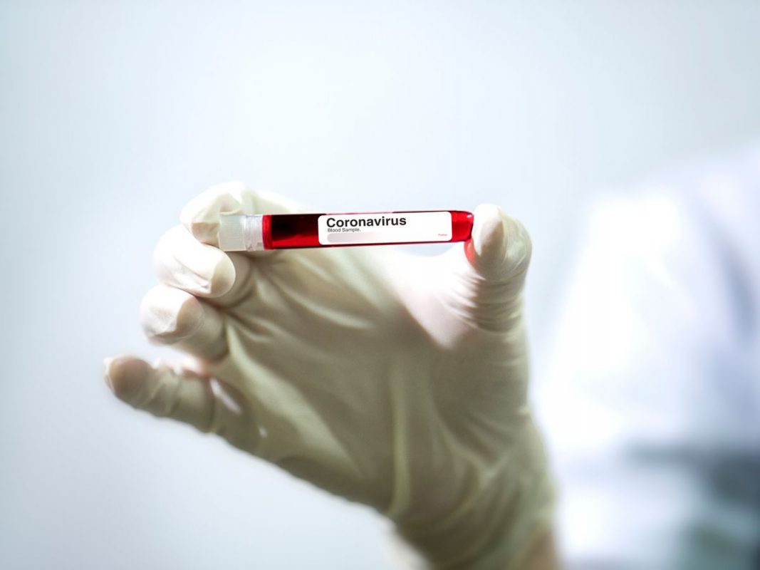Έρευνα: Η ομάδα αίματος Ο κινδυνεύει λιγότερο από τον κορονοϊό