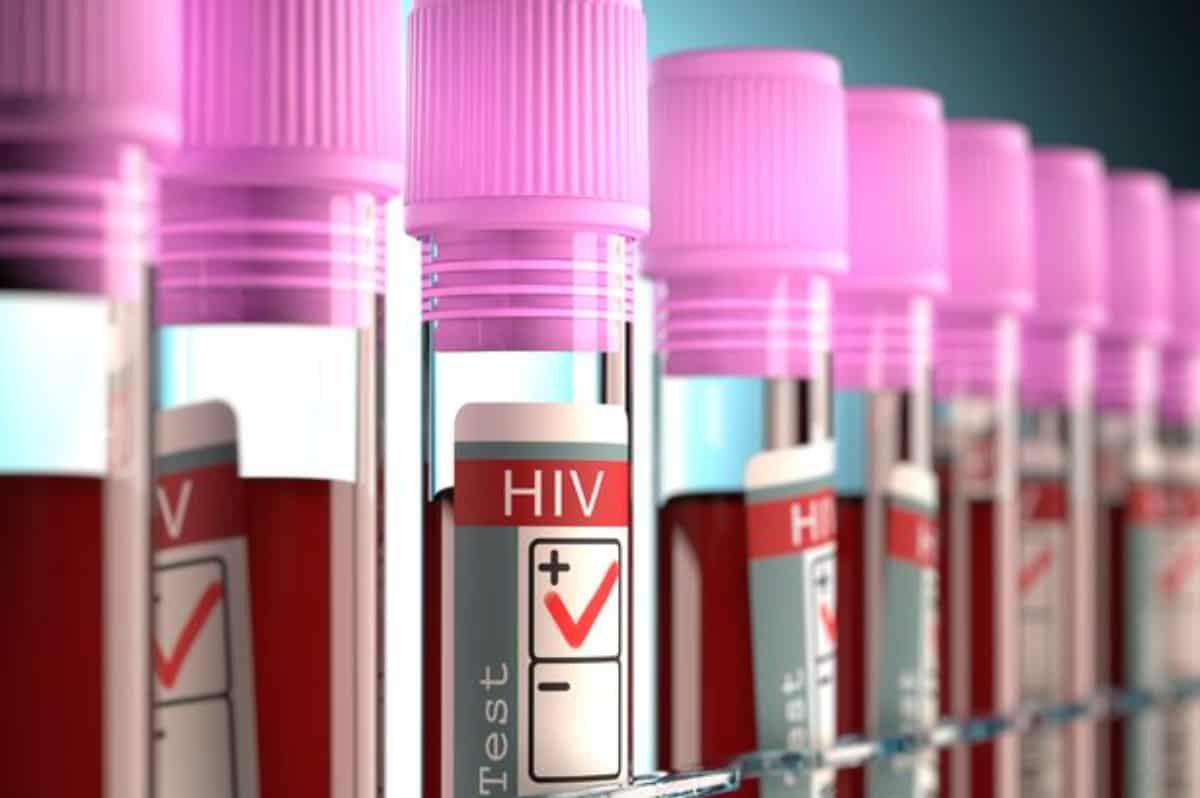 AIDS: Βραζιλιάνος ο πρώτος ασθενής που θεραπεύτηκε πιθανώς μόνο με φάρμακα