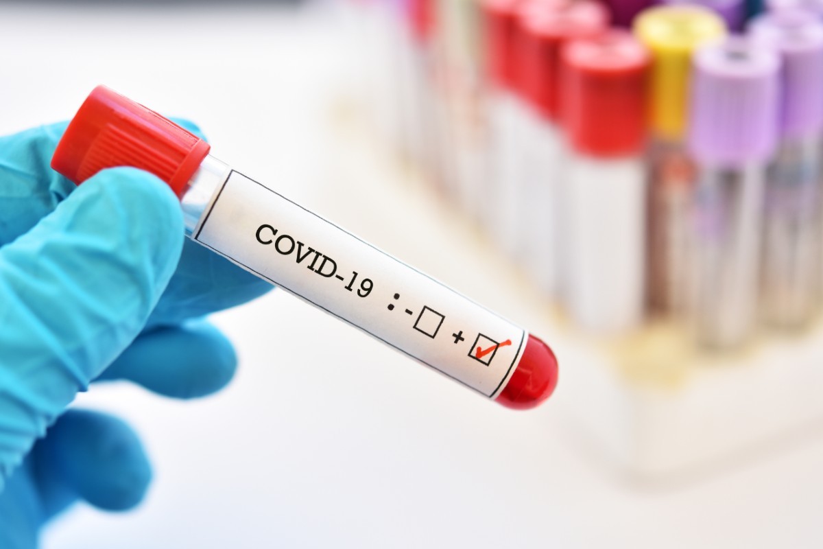 Έκρηξη κρουσμάτων: Οι αλλαγές σε πιστοποιητικά, άδειες, PCR και rapid test