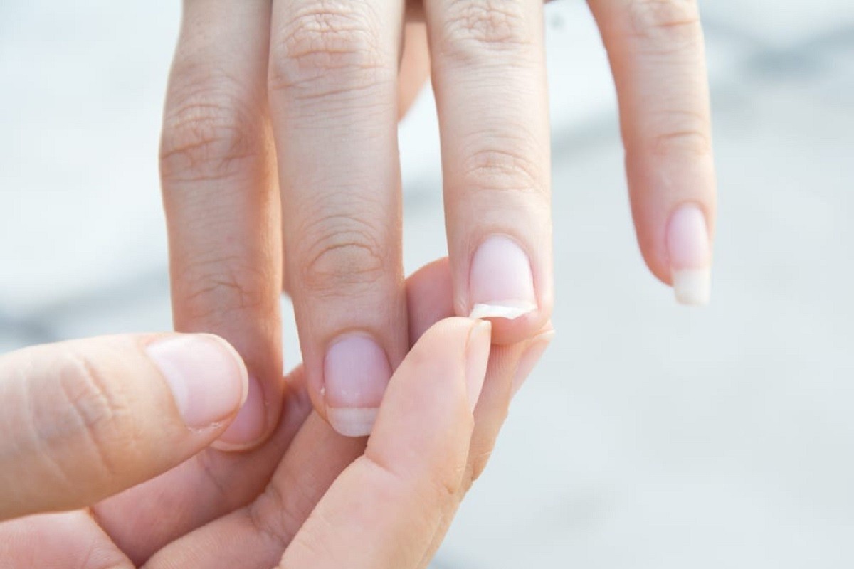 σπασμένα νύχια σε γυναικείο χέρι