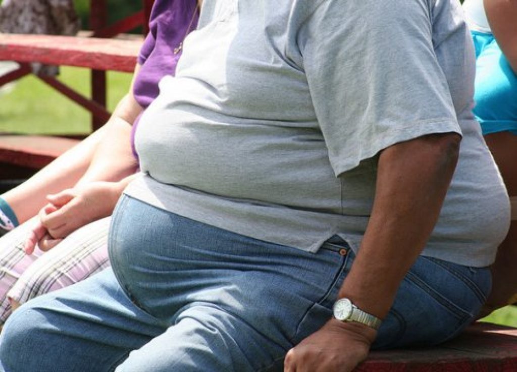 άνδρας με παχυσαρκία