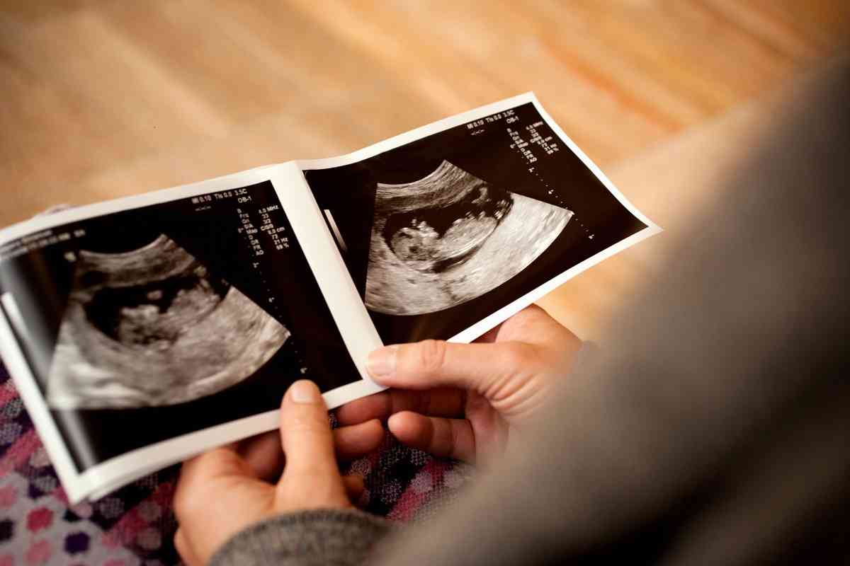 Εγκυμοσύνη: Μπορούμε να προλάβουμε τον πρόωρο τοκετό;