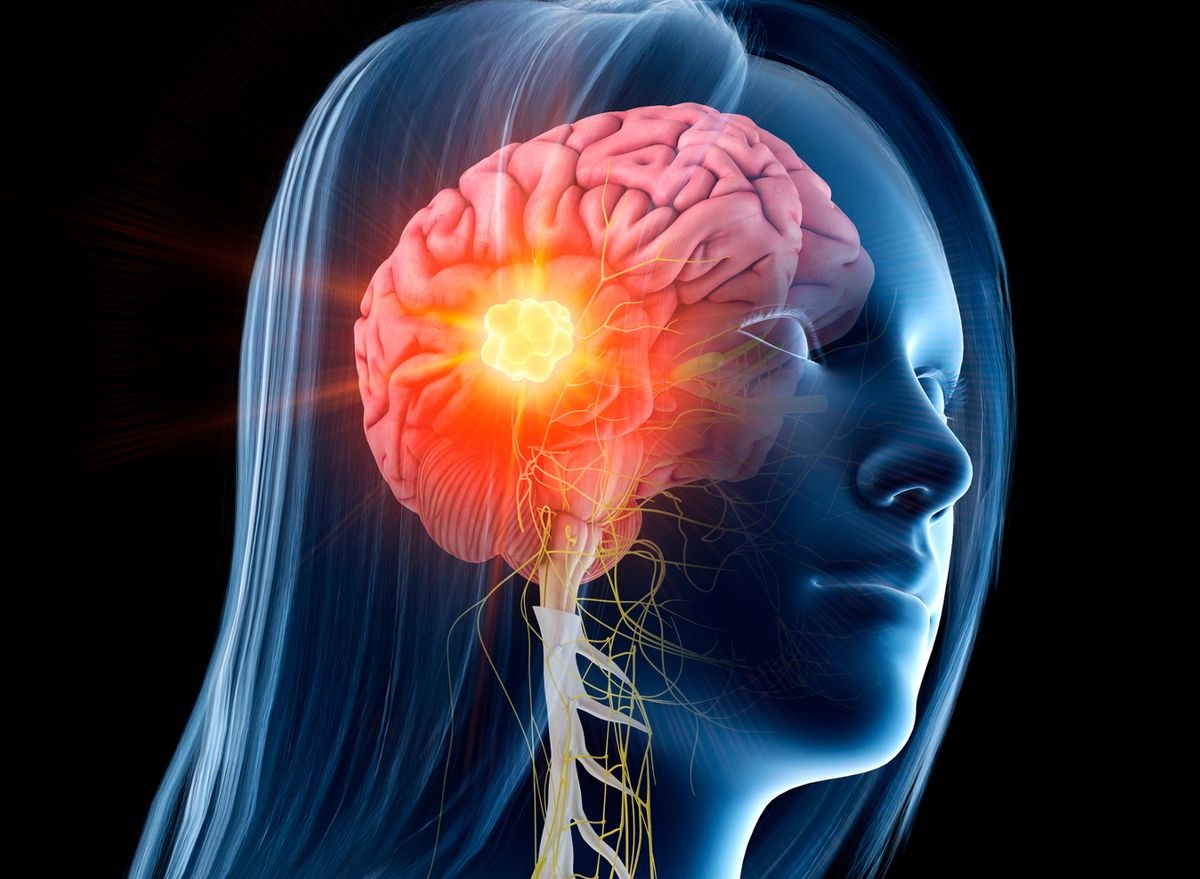 Εγκέφαλος: Τι συμβαίνει μετά από έναν τραυματισμό στο κεφάλι