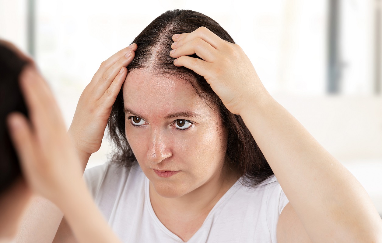 Μαλλιά: 5 συμβουλές για να αντιμετωπίσετε την τριχόπτωση