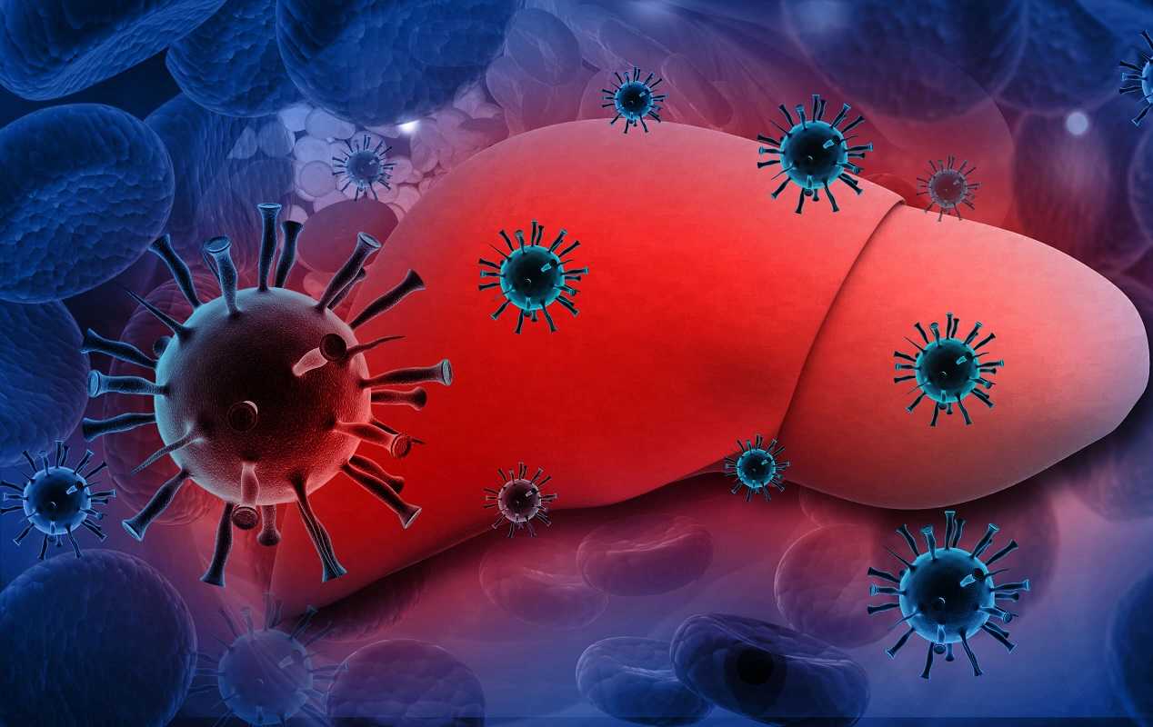 Ηπατίτιδα: Δεύτερη κύρια αιτία θανάτου παγκοσμίως