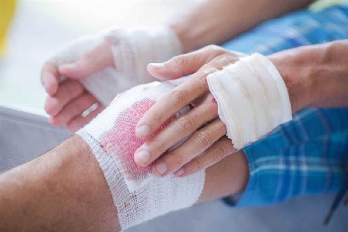 Αιμορραγία: 5 απλοί τρόποι για να τη σταματήσετε